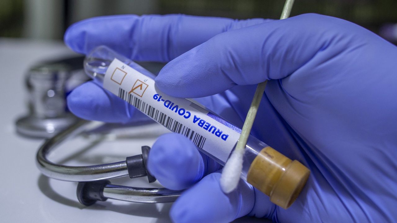 NFZ: w Szczecinie nie ma problemów z dostępnością testów na Covid-19